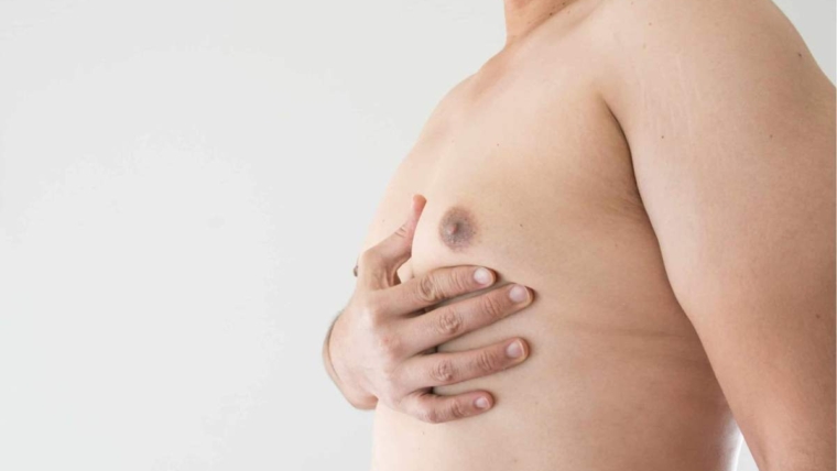 man boobs