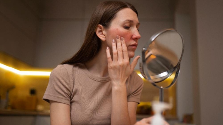 Dry Skin