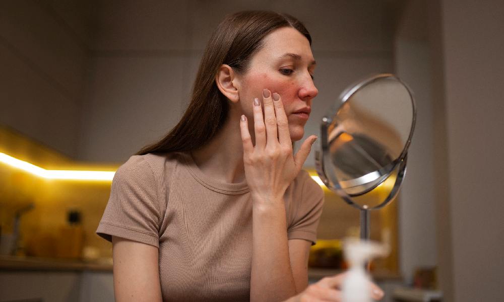 Dry Skin