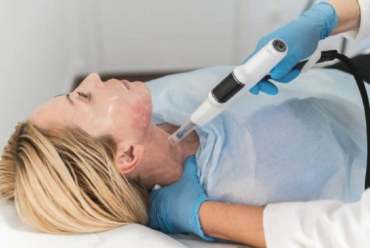 cynosure elite+ treatment