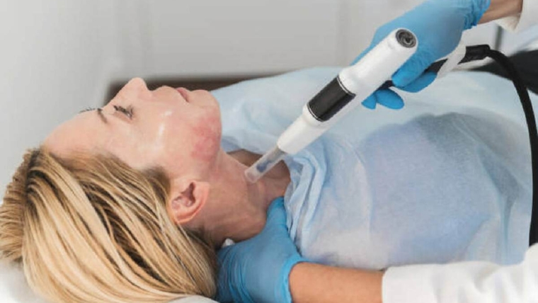 cynosure elite+ treatment