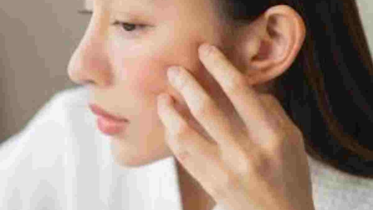 dry skin