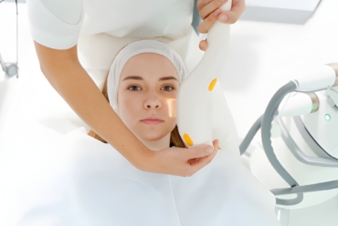 Laser Treatment for Pigmentation