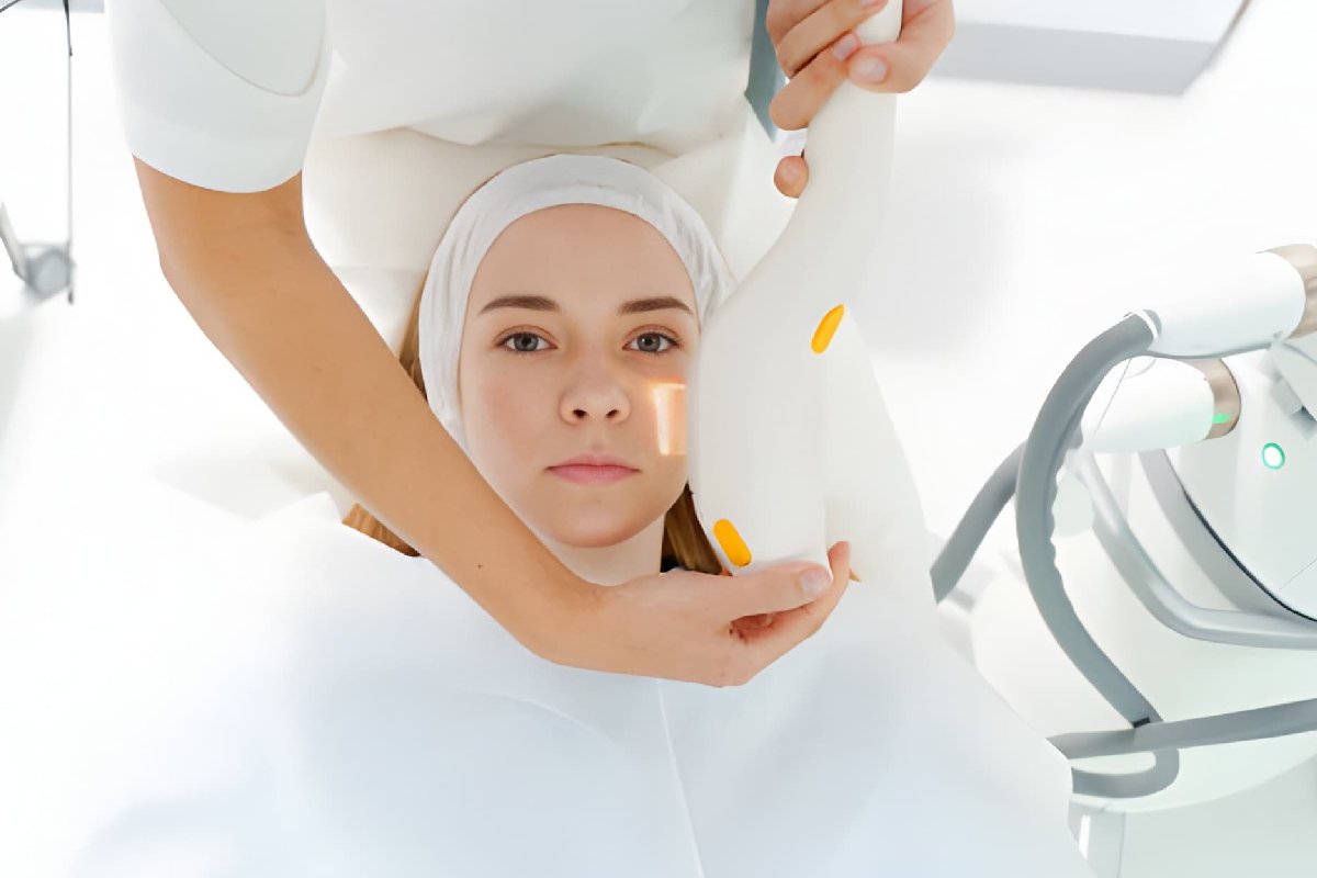 Laser Treatment for Pigmentation